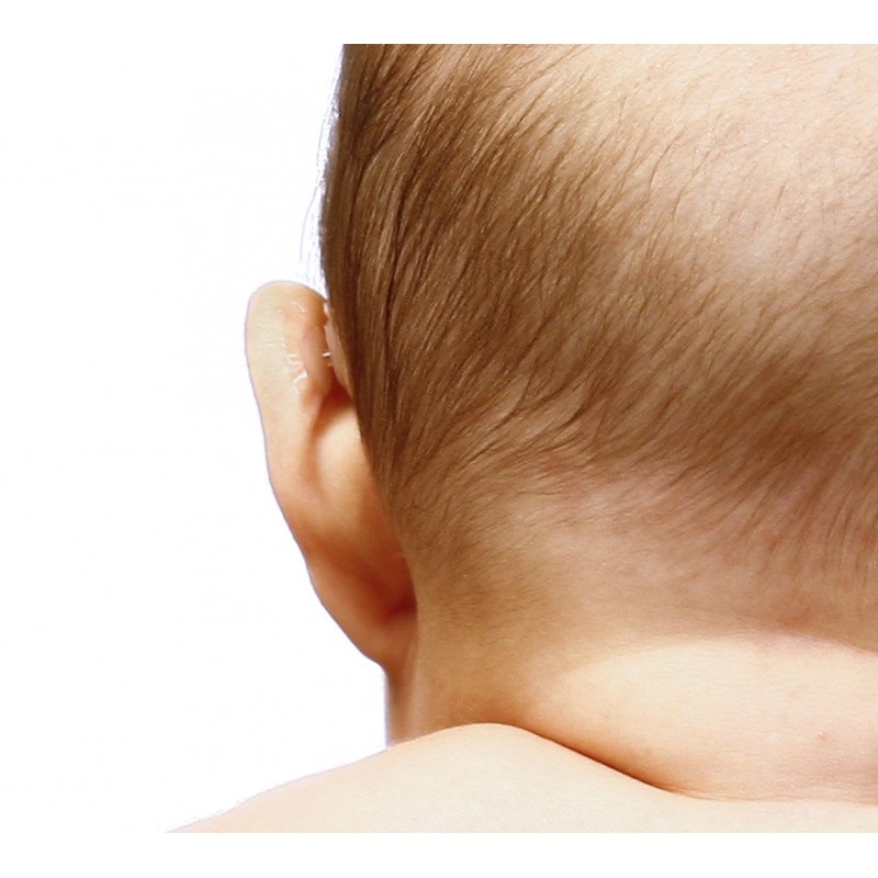Obrázek OTOSTICK Baby korektor odstávajících uší pro děti 8 kusů