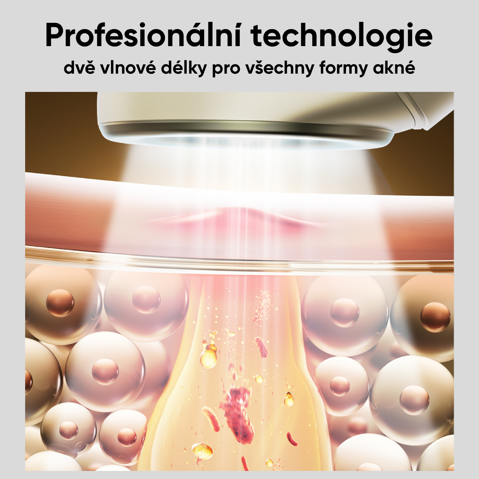 Obrázek JOVS Acneaway přístroj na léčbu akné