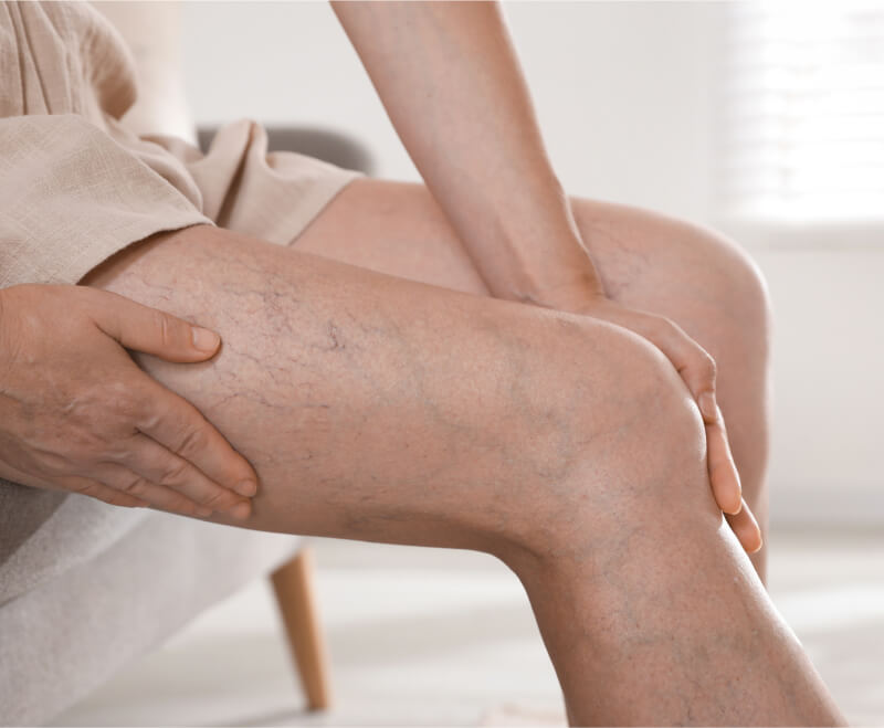 Obrázek DIOZEN Forte 1000mg 60 tablet (5)