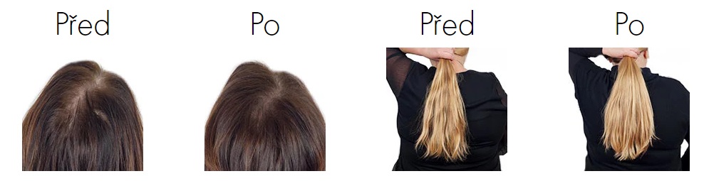 Obrázek VICHY Dercos Densi solutions Obnovující balzám pro hustší vlasy 200 ml