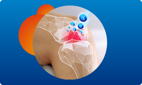 Obrázek VOLTAREN FORTE Gel 20 mg 180 g (8)