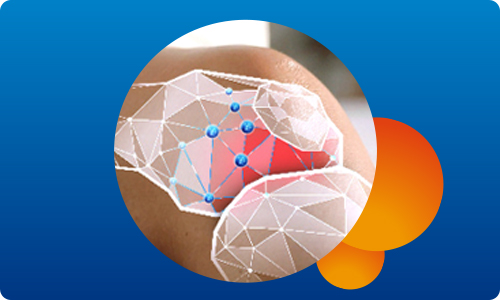 Obrázek VOLTAREN FORTE Gel 20 mg 150 g (10)