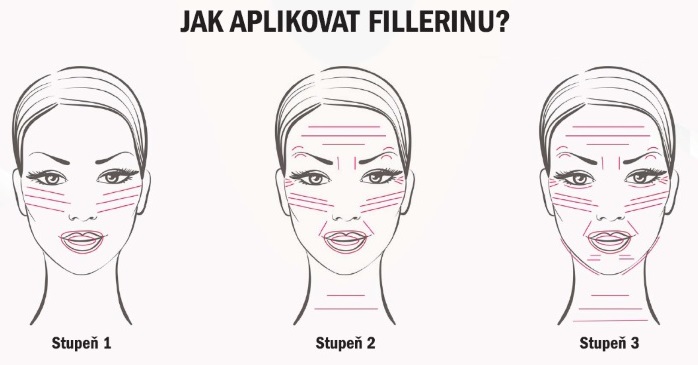 Obrázek FILLERINA Péče s vyplňujícím účinkem pro domácí použití 2x 28 ml stupeň 2