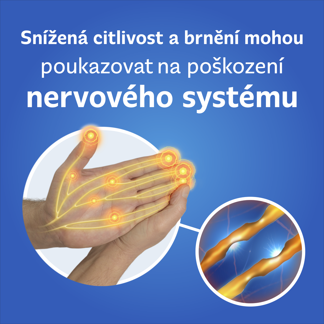 Obrázek NEUROBION 100mg/50mg/1mg 30 tablet (5)