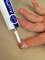 Obrázek ACTIMARIS Gel na hojení ran 20 g (2)