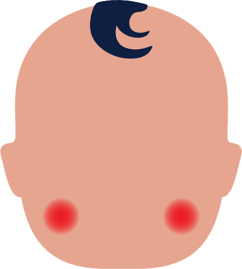 Obrázek NUROFEN Pro děti pomeranč suspenze 20 mg/ml 100 ml (14)