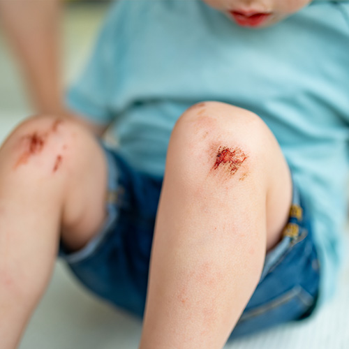 Obr&aacute;zek ALFASILVER HA+ kr&eacute;m 15 ml (4)