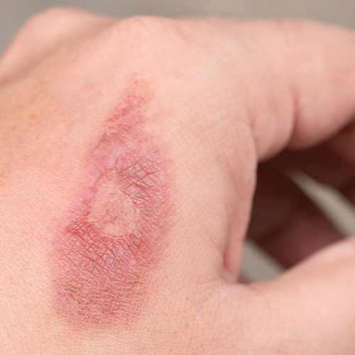 Obrázek ALFASILVER HA+ Práškový sprej 50 ml (3)