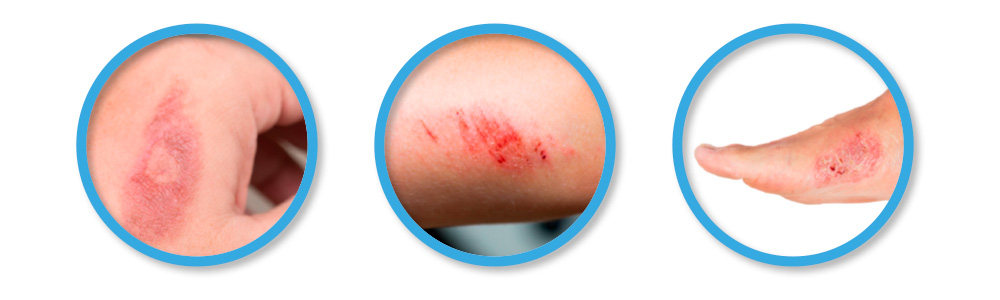 Obr&aacute;zek ALFASILVER HA+ kr&eacute;m 15 ml (6)