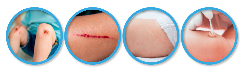 Obr&aacute;zek ALFASILVER HA+ Pr&aacute;&scaron;kov&yacute; sprej 125 ml (6)