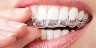 Obrázek WHITE PEARL Systém na bělení zubů 130 ml